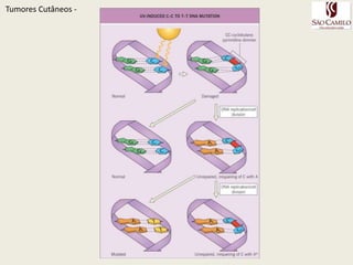 TumoresCutâneos - 
