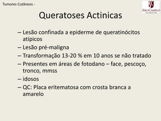 TumoresCutâneos - 