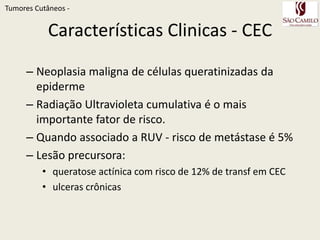 TumoresCutâneos - Carcinoma espinocelular