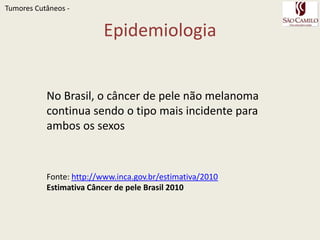 Cânceres cutâneos não MelanomaA incidência de CCNM tem relação:Direta com a  exposição à radiação ultravioleta Inversa com o grau de pigmentação cutâneaMais freqüente em indivíduos que sempre se queimam e nunca se bronzeiamFreqüência aumenta à medida que se aproxima do equadorTumoresCutâneos - 