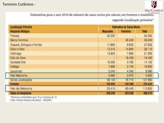 No Brasil, o câncer de pele não melanoma continua sendo o tipo mais incidente para ambos os sexosFonte: http://www.inca.gov.br/estimativa/2010Estimativa Câncer de pele Brasil 2010EpidemiologiaTumoresCutâneos - 