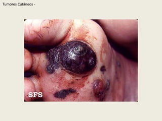 TumoresCutâneos - 