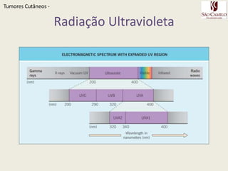 TumoresCutâneos - Etiologia e PatogeneseFatores extrínsecos:Radiação ultravioletaRadiação ionizanteCarcinógenos químicosPapilomavírus humano -  HPVFatores intrínsecosFatores genéticosLesões precursorasFatores imunológicos