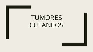 TUMORES
CUTÁNEOS
 