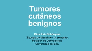 Tumores
cutáneos
benignos
Dina Ruiz Bohórquez
Escuela de Medicina – IX semestre
Rotación de Dermatología
Universidad del Sinú
 