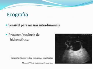 Ecografia
 Sensível para massas intra-luminais.


 Presença/ausência de
  hidronefrose.




   Ecografia: Tumor vesical com zonas calcificadas

               Manual CTO de Medicina y Cirugía, 2011
 