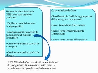 Sistema de classificação da             Características de Grau:
OMS 2004 para tumores
papilares:                              Classificação da OMS de 1973 segundo
                                        diferentes graus de anaplasia:
• Papiloma urotelial (tumor
benigno papilar)                        Grau 1: tumor bem diferenciado

• Neoplasia papilar urotelial de        Grau 2: tumor moderadamente
baixo potencial maligno                 Diferenciado
(PUNLMP)
                                        Grau 3: tumor pouco diferenciado
• Carcinoma urotelial papilar de
baixo grau

• Carcinoma urotelial papilar de
alto grau

 PUNLMPs são lesões que não têm características
 de malignidade .Têm um risco muito baixo de
 invasão mas com grande tendência a recidivar.
 