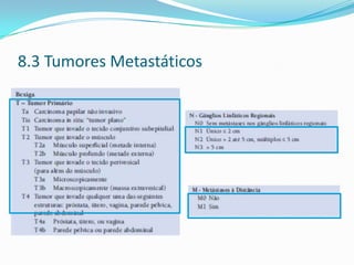 8.3 Tumores Metastáticos
 
