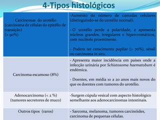 4-Tipos histológicos
                                       -Aumento do número de camadas celulares
      Carcinomas do urotélio           (distinguindo-se do urotélio normal).
(carcinoma de células do epitélio de
transição)                             - O urotélio perde a polaridade, e apresenta
(> 90%)                                núcleos grandes, irregulares e hipercromáticos,
                                       com nucléolo proeminente.

                                       - Podem ter crescimento papilar (> 70%), séssil
                                       ou carcinoma in situ.
                                       - Apresenta maior incidência em países onde a
                                       infecção urinária por Schistosoma haematobum é
                                       endémica.
    Carcinoma escamoso (8%)
                                       - Doentes, em média 10 a 20 anos mais novos do
                                       que os doentes com tumores do urotélio.

      Adenocarcinoma (< 2 %)           -Surgem cúpula vesical com aspecto histológico
   (tumores secretores de muco)        semelhante aos adenocarcinomas intestinais.

       Outros tipos (raros)            - Sarcoma, melanoma, tumores carcinóides,
                                       carcinoma de pequenas células.
 
