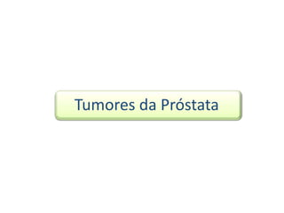     Tumores da Próstata 