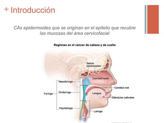 + Introducción
CAs epidermoides que se originan en el epitelio que recubre
las mucosas del área cervicofacial
 