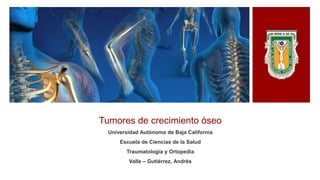 Tumores de crecimiento óseo
Universidad Autónoma de Baja California
Escuela de Ciencias de la Salud
Traumatología y Ortopedia
Valle – Gutiérrez, Andrés
 