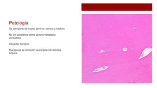 Patología
Se compone de hueso laminar, denso y maduro.
No se considera como tal una neoplasia
verdadera.
Carácter benigno.
Manejo es la remoción quirúrgica con bordes
limpios.
 