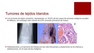 Tumores de tejidos blandos
 Los tumores de tejido conectivo, representan un 16.6% de los casos de tumores malignos anuales
en México, sin embargo solo menos de 0.6% tumores primarios de hueso.
 Osteosarcoma y el sarcoma de Ewing son los más frecuentes y predominan en la infancia y
adolescencia, en el caso de los malignos.
 