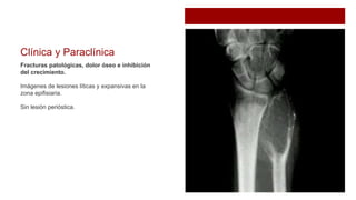 Clínica y Paraclínica
Fracturas patológicas, dolor óseo e inhibición
del crecimiento.
Imágenes de lesiones líticas y expansivas en la
zona epifisiaria.
Sin lesión perióstica.
 