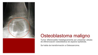 Osteoblastoma maligno
Tumor diferenciable histológicamente por presentar células
de diferenciación osteoblástica de aspecto epiteloide.
Se habla de transformación a Osteosarcoma.
 