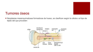 Tumores óseos
 Neoplasias mesenquimatosas formadoras de hueso, se clasifican según la célula o el tipo de
tejido del que proceden
 