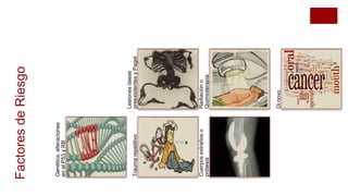 Genética,alteraciones
enelP53yRB
Traumarepetitivo
Cuerposextrañoso
prótesis
Lesionesóseas
preexistentesyPaget
Radiacióno
Quimioterapia
Dinovo
FactoresdeRiesgo
 