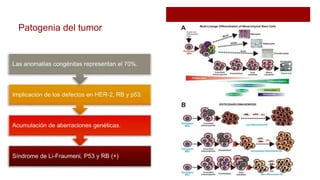 Patogenia del tumor
 
