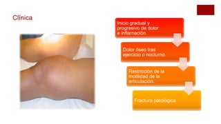 Clínica
Inicio gradual y
progresivo de dolor
e inflamación.
Dolor óseo tras
ejercicio o nocturno.
Restricción de la
motilidad de la
articulación.
Fractura patológica
 