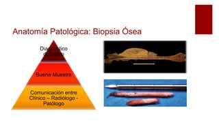 Anatomía Patológica: Biopsia Ósea
Diagnostico
definitivo
Buena Muestra
Comunicación entre
Clínico – Radiólogo -
Patólogo
 