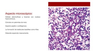 Aspecto microscópico:
Células pleomorficas y bizarras con núcleos
hipercrómicos.
Cúmulos en palomitas de maíz.
Aspecto papilar o cartilaginoso.
La formación de trabéculas basófilas como hifas.
Osteoide esparcido masivamente.
 