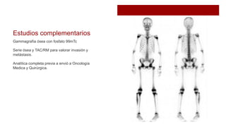 Estudios complementarios
Gammagrafía ósea con fosfato 99mTc
Serie ósea y TAC/RM para valorar invasión y
metástasis.
Analítica completa previa a envió a Oncología
Medica y Quirúrgica.
 