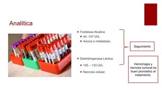 Analítica
 Fosfatasa Alcalina:
 44 -147 UI/L
 Asocia a metástasis.
 Deshidrogenasa Láctica:
 105 – 133 UI/L
 Necrosis celular.
Seguimiento
Hemorragia y
necrosis tumoral es
buen pronostico al
tratamiento.
 