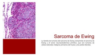 Sarcoma de Ewing
La familia de tumores del sarcoma de Ewing comprende el sarcoma de
Ewing y el tumor neuroectodérmico primitivo, que son tumores de
célula redondas malignos primarios del hueso y las partes blandas
 