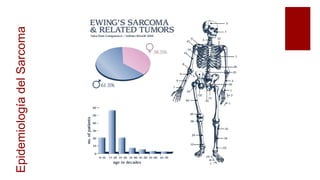 EpidemiologíadelSarcoma
 