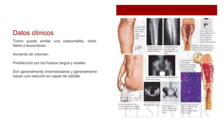Datos clínicos
Tumor puede similar una osteomielitis, dolor,
fiebre y leucocitosis.
Aumento de volumen.
Predilección por los huesos largos y axiales.
Son generalmente intramedulares y generalmente
hacen una reacción en capas de cebolla.
 