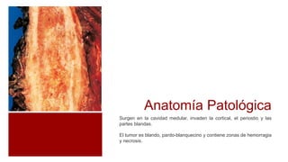 Anatomía Patológica
Surgen en la cavidad medular, invaden la cortical, el periostio y las
partes blandas.
El tumor es blando, pardo-blanquecino y contiene zonas de hemorragia
y necrosis.
 