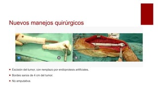 Nuevos manejos quirúrgicos
 Escisión del tumor, con remplazo por endoprotesis artificiales.
 Bordes sanos de 4 cm del tumor.
 No amputativa.
 
