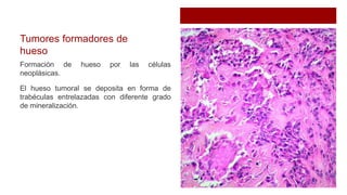 Tumores formadores de
hueso
Formación de hueso por las células
neoplásicas.
El hueso tumoral se deposita en forma de
trabéculas entrelazadas con diferente grado
de mineralización.
 
