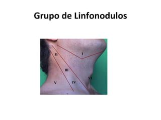 Grupo de Linfonodulos
 