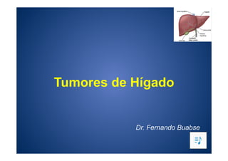 Tumores de Hígado Dr Fernando Buabse.pdf