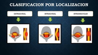 TUMORES DE LA COLUMNA VERTEBRAL.......... | PPTX