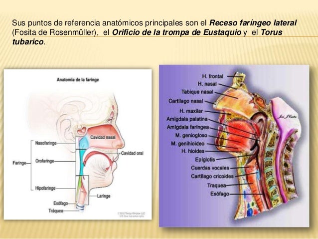 Tumores de la nasofaringe