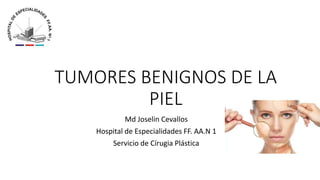 TUMORES BENIGNOS DE LA
PIEL
Md Joselin Cevallos
Hospital de Especialidades FF. AA.N 1
Servicio de Círugia Plástica
 