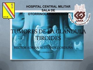 HOSPITAL CENTRAL MILITAR
SALA DE
OTORRINOLARINGOLOGÍA

TUMORES DE LA GLANDULA
TIROIDES
HECTOR ADRIAN HERNANDEZ ORDUÑA

 