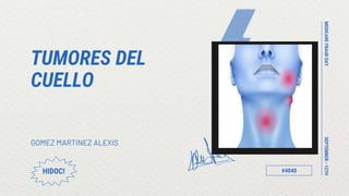 SEPTEMBER
-
12TH
MEDICARE
FRAUD
DAY
TUMORES DEL
CUELLO
GOMEZ MARTINEZ ALEXIS
HIDOC! #4040
 