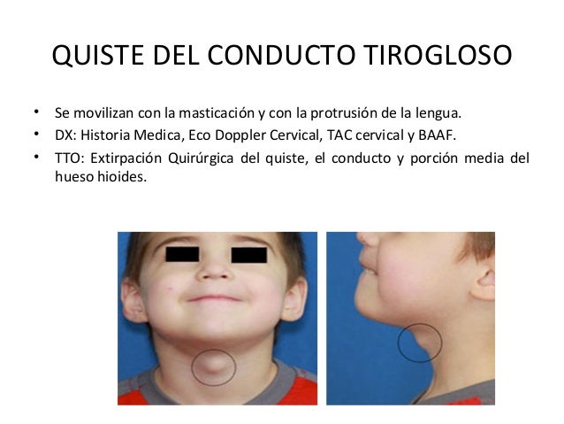 El dolor que tira en el lado izquierdo en lo bajo del vientre que da en la espalda