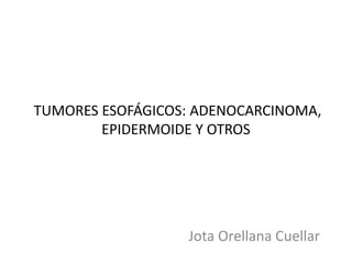 TUMORES ESOFÁGICOS: ADENOCARCINOMA,
EPIDERMOIDE Y OTROS

Jota Orellana Cuellar

 
