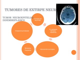 TUMORES DE EXTIRPE NEURONAL: TUMOR  NEUROEPITELIAL DISEMBRIPLÁSICO 