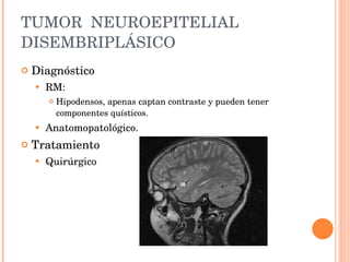 TUMOR  NEUROEPITELIAL DISEMBRIPLÁSICO Diagnóstico RM: Hipodensos, apenas captan contraste y pueden tener componentes quísticos.  Anatomopatológico.     Tratamiento  Quirúrgico 