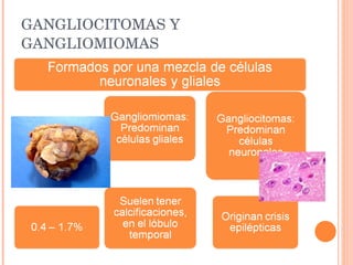 GANGLIOCITOMAS Y GANGLIOMIOMAS 
