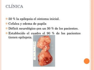 CLÍNICA 50 % la epilepsia el síntoma inicial.  Cefalea y edema de papila Déficit neurológico çen un 30 % de los pacientes.  Establecido el cuadro el 90 % de los pacientes tienen epilepsia. 
