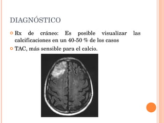 DIAGNÓSTICO Rx de cráneo: Es posible visualizar las calcificaciones en un 40-50 % de los casos TAC, más sensible para el calcio. 