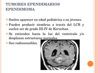 TUMORES EPENDIMARIOS EPENDIMOMA Suelen aparecer en edad pediátrica o en jóvenes. Pueden producir siembras a través del LCR y suelen ser de grado III-IV de Kernohan. Se extienden hacia la luz del ventrículo y/o desplazan estructuras normales Son radiosensibles. 
