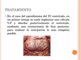 TRATAMIENTO En el caso del ependimoma del IV ventrículo, en un primer tiempo se suele implantar una válvula V-P y abordar posteriormente el ventrículo, mediante una craniectomía de fosa posterior, para realizar la extirpación lo más completa posible.  